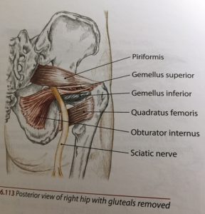 sciatica shooting pain